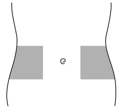 IFU Fig E.jpg Figure E - IFU Fig E